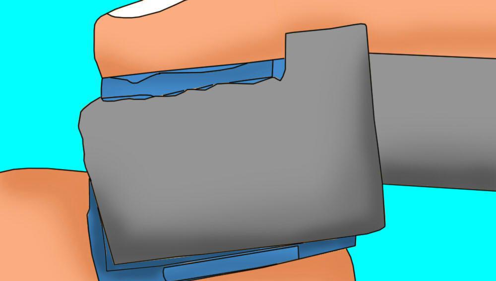 Partie 3 de 4 : Transfert de la conduite de frein vers le nouvel étrier